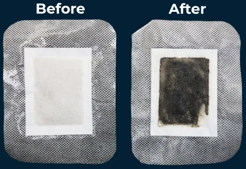 Xitox Foot Pads Before and After